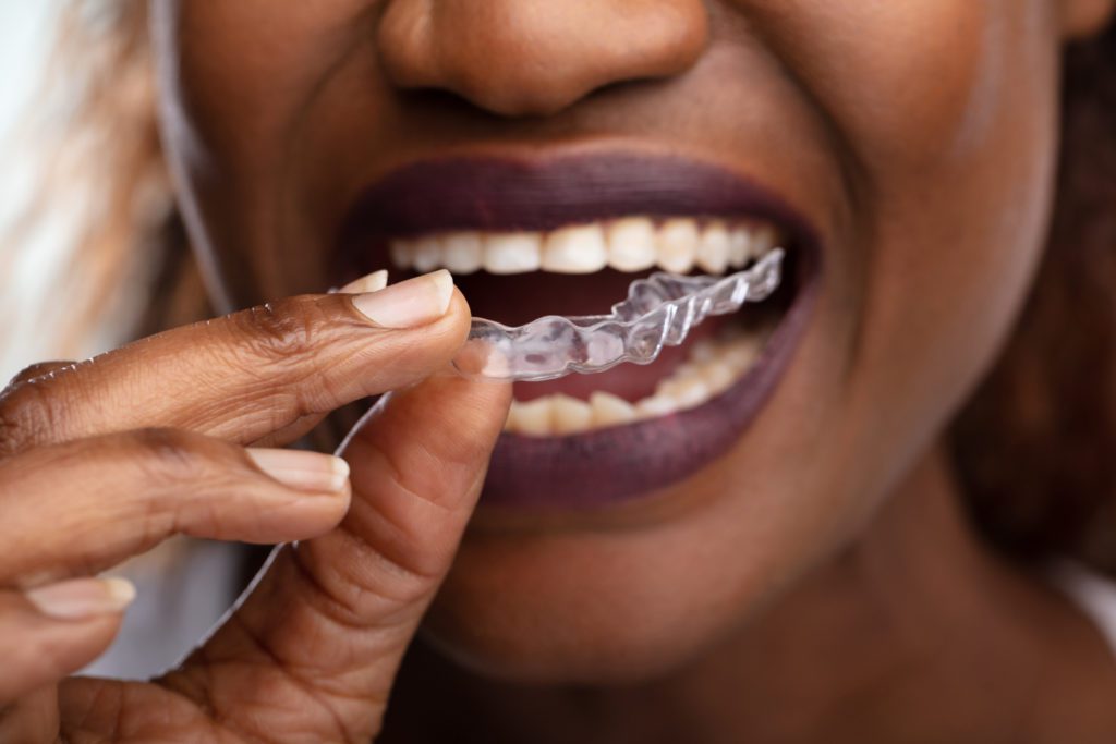 Invisalign Treatment in Doylestown, Pennsylvania