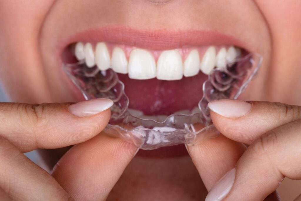 Changing Your Smile with Invisalign 