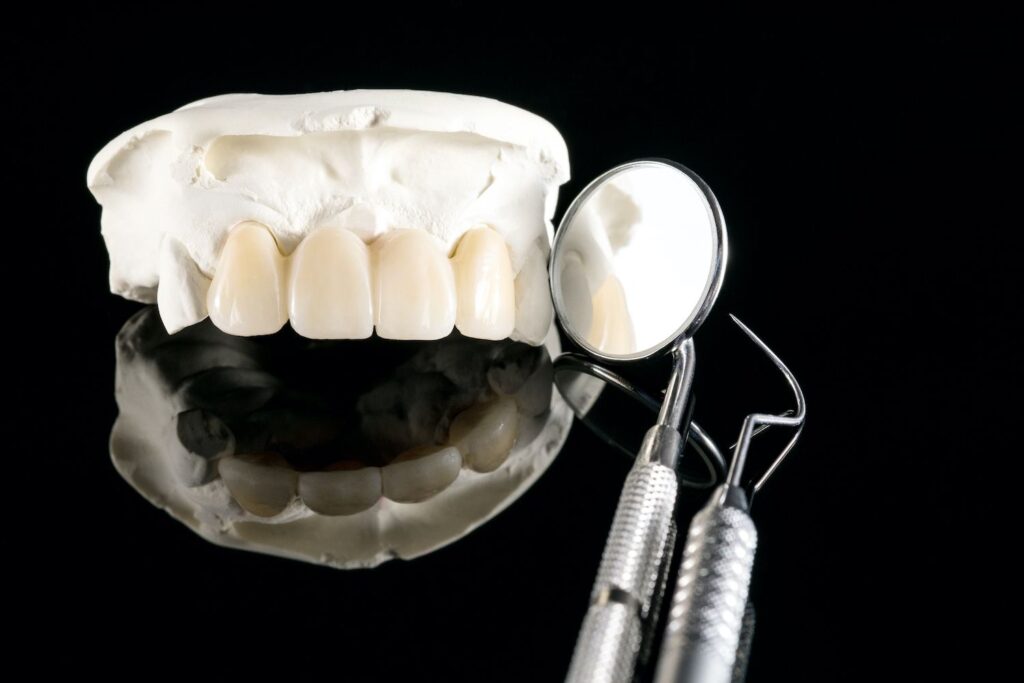 Dental Crowns to Protect Your Smile